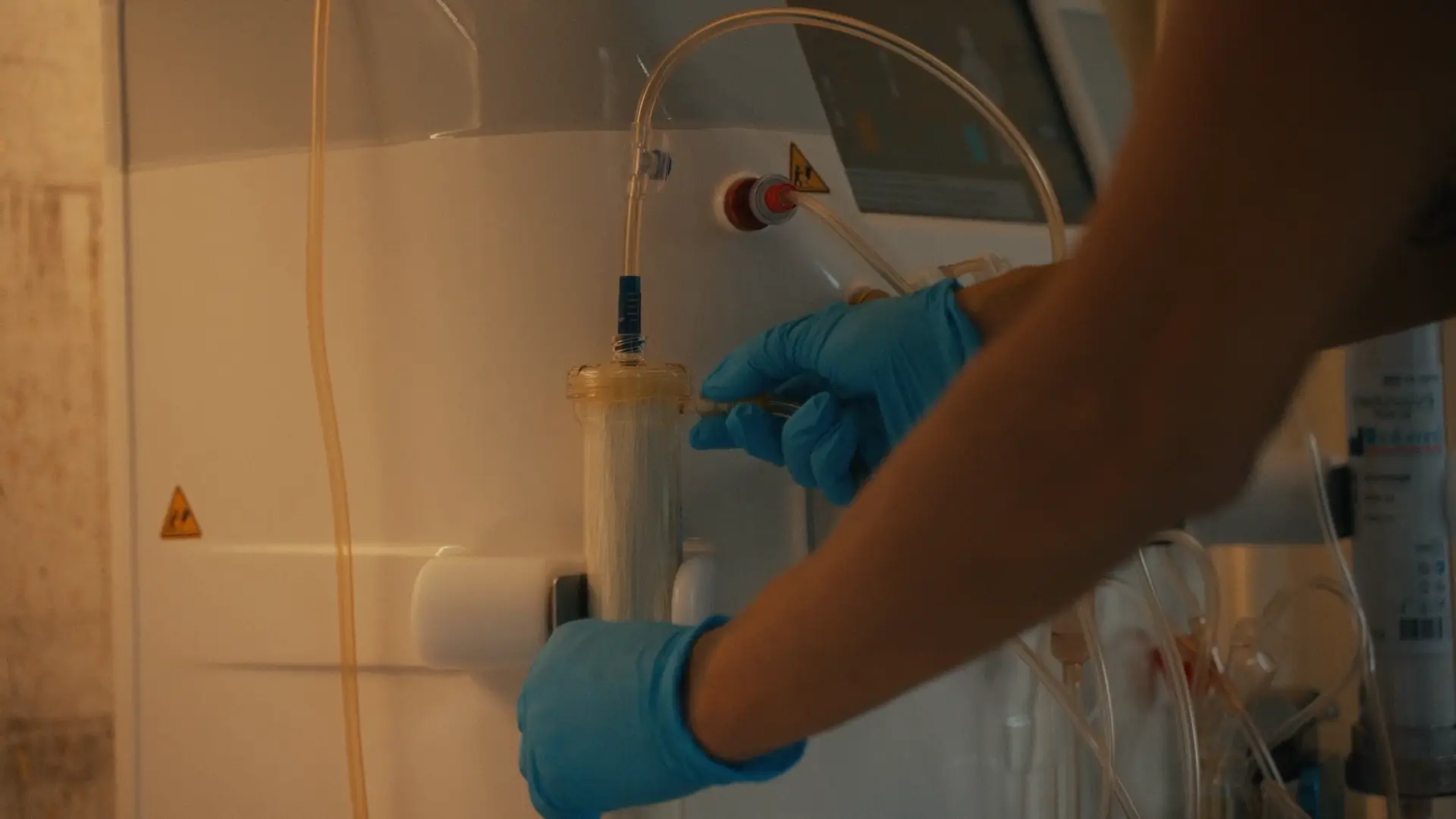 A nurse connecting the primary plasma separation filter